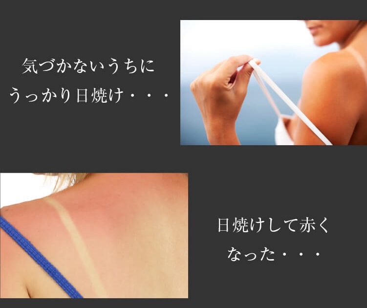 日焼け-アフターケア-メンズ-画像6